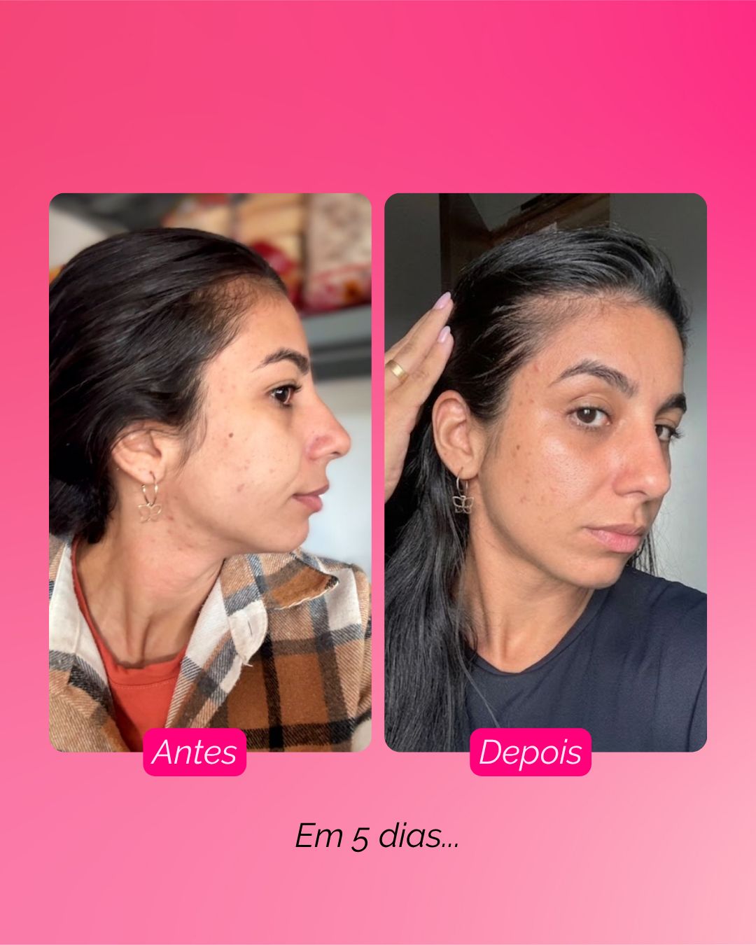 Resultado sooē — 7 dias